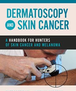 Dermatoscopy and Skin Cancer by Rosendahl
