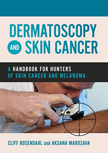 Dermatoscopy and Skin Cancer by Rosendahl