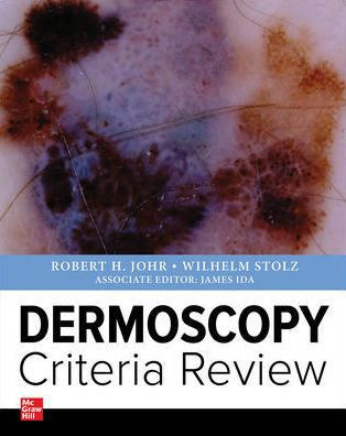Dermoscopy Criteria Review by Wilhelm Stolz