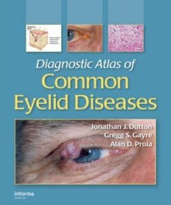 Diagnostic Atlas of Common Eyelid Diseases By Jonathan J. Dutton