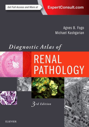 Diagnostic Atlas of Renal Pathology 3rd Edition by Agnes B. Fogo