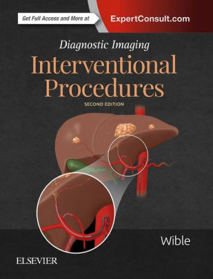 Diagnostic Imaging - Interventional Procedures 2nd Ed by Wible