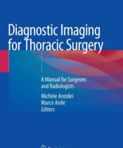 Diagnostic Imaging for Thoracic Surgery by Michele Anzidei