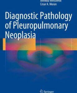 Diagnostic Pathology of Pleuropulmonary Neoplasia by Annikka Weissferdt