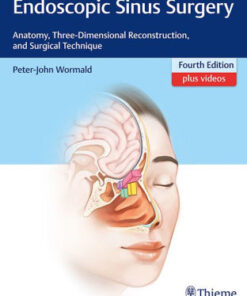 Endoscopic Sinus Surgery 4th Edition by Peter J. Wormald