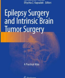 Epilepsy Surgery and Intrinsic Brain Tumor Surgery by Fountas