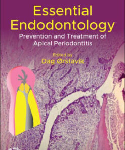 Essential Endodontology 3rd Edition by Dag Orstavik