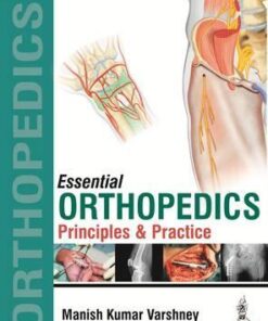 Essential Orthopedics - Principles and Practice 2 Vol Set by Varshney