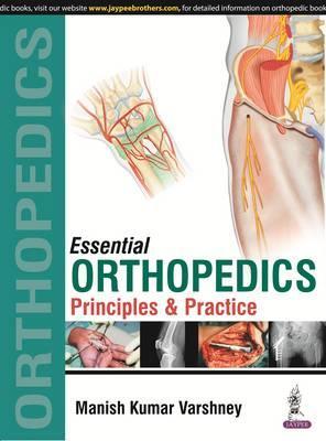 Essential Orthopedics - Principles and Practice 2 Vol Set by Varshney