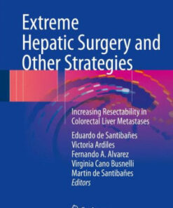 Extreme Hepatic Surgery and Other Strategies by Santibañes