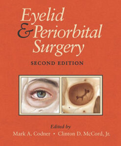 Eyelid and Periorbital Surgery 2nd Edition by Mark Codner