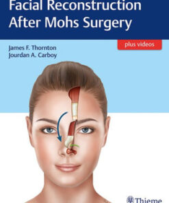 Facial Reconstruction After Mohs Surgery by James Thornton