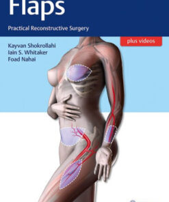Flaps - Practical Reconstructive Surgery by Shokrollahi