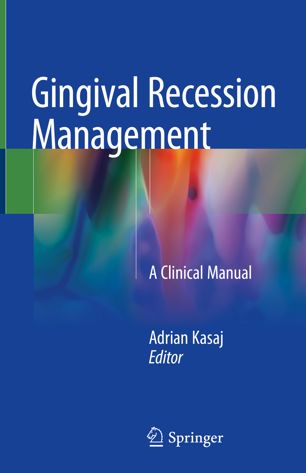 Gingival Recession Management - A Clinical Manual By Adrian Kasaj