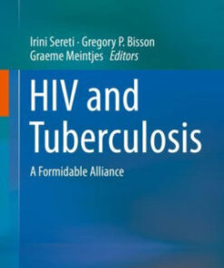 HIV and Tuberculosis - A Formidable Alliance by Irini Sereti