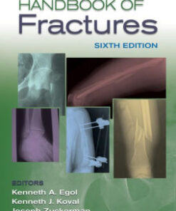 Handbook of Fractures 6th Edition by Kenneth Egol