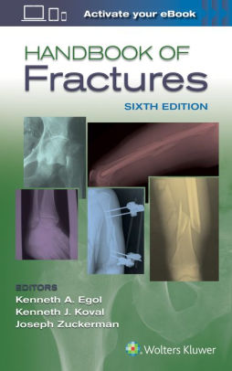 Handbook of Fractures 6th Edition by Kenneth Egol