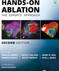 Hands On Ablation The Experts' Approach 2nd Edition by Amin Al Ahmad