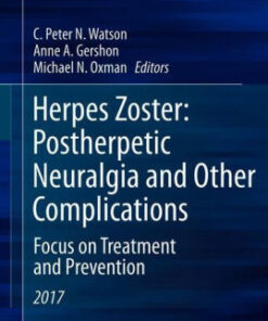Herpes Zoster - Postherpetic Neuralgia and Other Complications by Watson