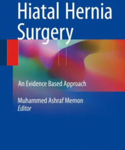 Hiatal Hernia Surgery by Muhammed Ashraf Memon