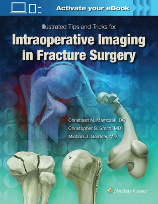 Illustrated Tips and Tricks for Intraoperative Imaging by Gardner