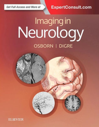 Imaging in Neurology by Anne G. Osborn