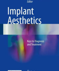 Implant Aesthetics - Keys to Diagnosis and Treatment by Edward Dwayne Karateew