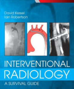 Interventional Radiology 4th Edition by David Kessel