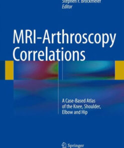 MRI Arthroscopy Correlations - A Case Based Atlas by Brockmeier