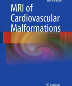 MRI of Cardiovascular Malformations by Bruno Kastler