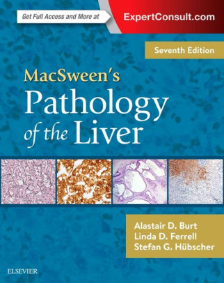 MacSween's Pathology of the Liver 7th Edition by Alastair D. Burt