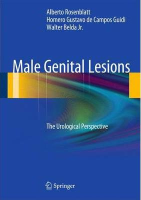 Male Genital Lesions The Urological Perspective By Alberto Rosenblatt