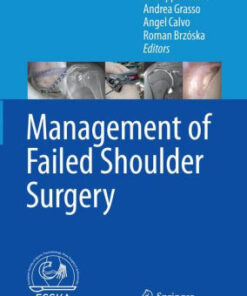Management of Failed Shoulder Surgery by Milano