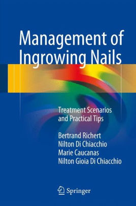 Management of Ingrowing Nails by Bertrand Richert