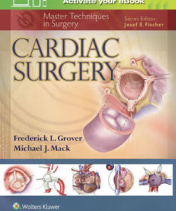 Master Techniques in Surgery - Cardiac Surgery by Grover