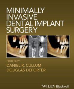 Minimally Invasive Dental Implant Surgery by Daniel R. Cullum