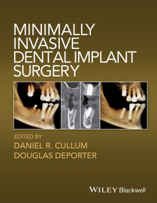 Minimally Invasive Dental Implant Surgery by Daniel R. Cullum