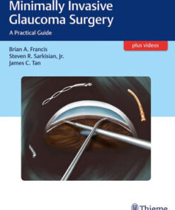 Minimally Invasive Glaucoma Surgery By Brian Francis