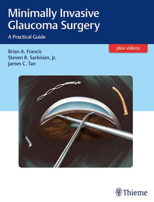 Minimally Invasive Glaucoma Surgery By Brian Francis