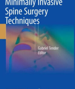 Minimally Invasive Spine Surgery Techniques by Gabriel Tender