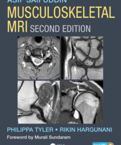 Musculoskeletal MRI 2nd Edition by Asif Saifuddin
