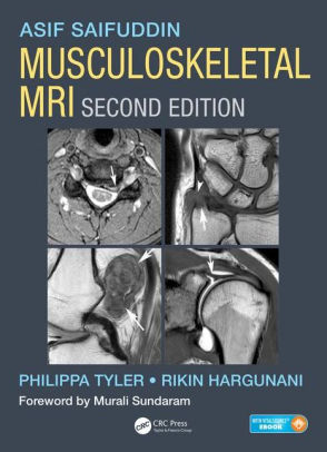 Musculoskeletal MRI 2nd Edition by Asif Saifuddin