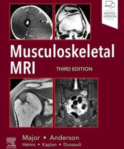 Musculoskeletal MRI 3rd Edition by Nancy M. Major