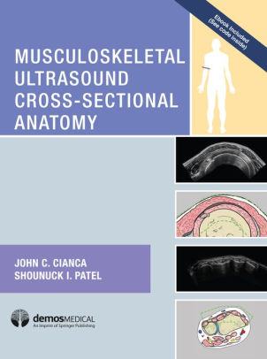 Musculoskeletal Ultrasound Cross-Sectional Anatomy by Cianca