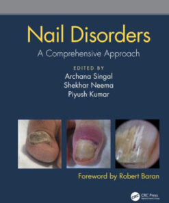 Nail Disorders - A Comprehensive Approach by Archana Singal