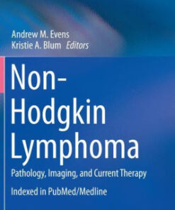 Non Hodgkin Lymphoma - Pathology
