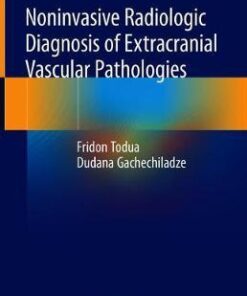 Noninvasive Radiologic Diagnosis of Extracranial Vascular by Todua