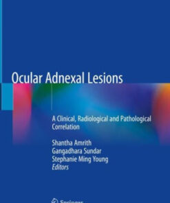 Ocular Adnexal Lesions by Shantha Amrith