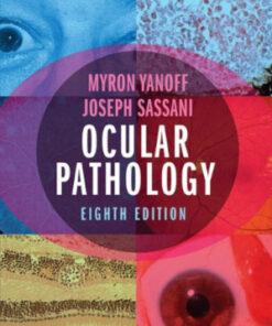 Ocular Pathology 8th Edition by Myron Yanoff