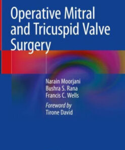 Operative Mitral and Tricuspid Valve Surgery by Narain Moorjani